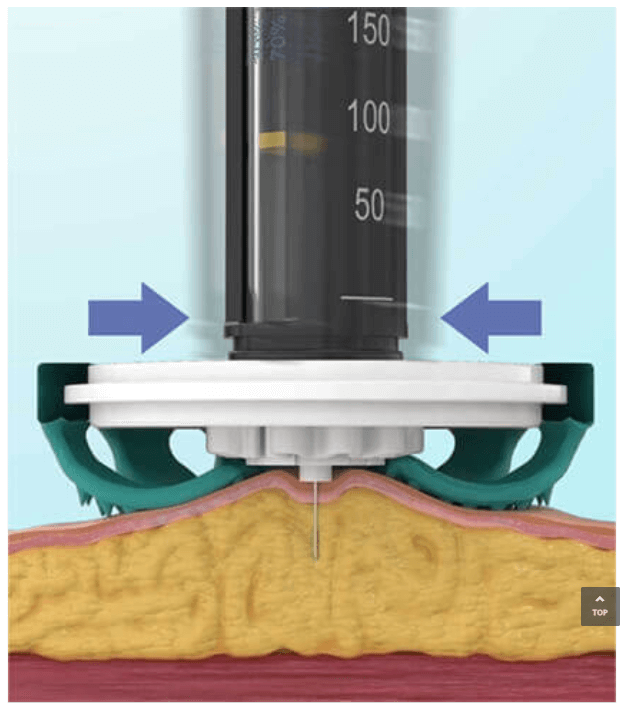 Diabeteshjalp insulin hjälpmedel TickleFLEX novo rapid Injection reducering – Gör sticket Enklare och Bekvämare