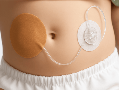 Infusionsset Patch för TruSteel™ - Högkvalitativa patchar som säkerställer stabilitet och komfort för ditt TruSteel infusionsset, perfekt för aktivt bruk och längre användning.