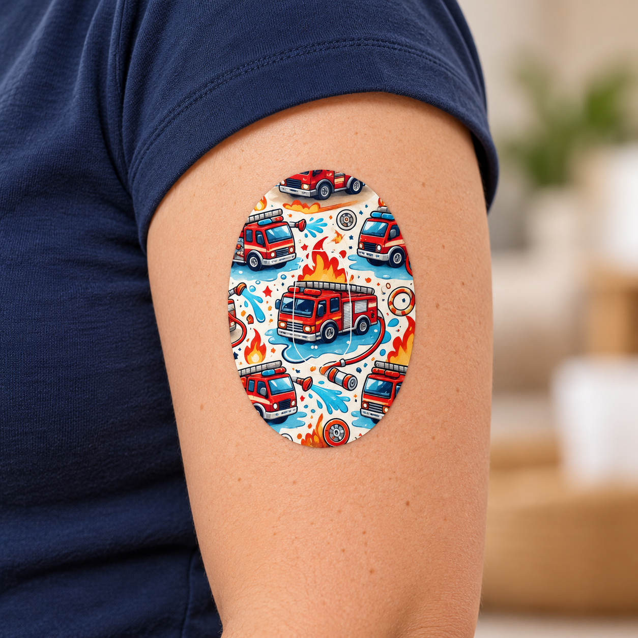 Brandbil CGM-Sensor overpatches för Dexcom G6 inkl. Sensor Stickers