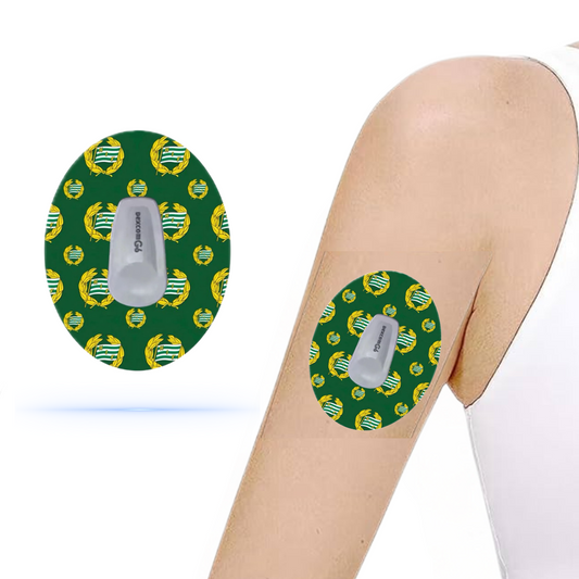 Hammarby IF CGM sensor patches som visar upp lagets färger, designade för Dexcom G6, applicerade på en arm.