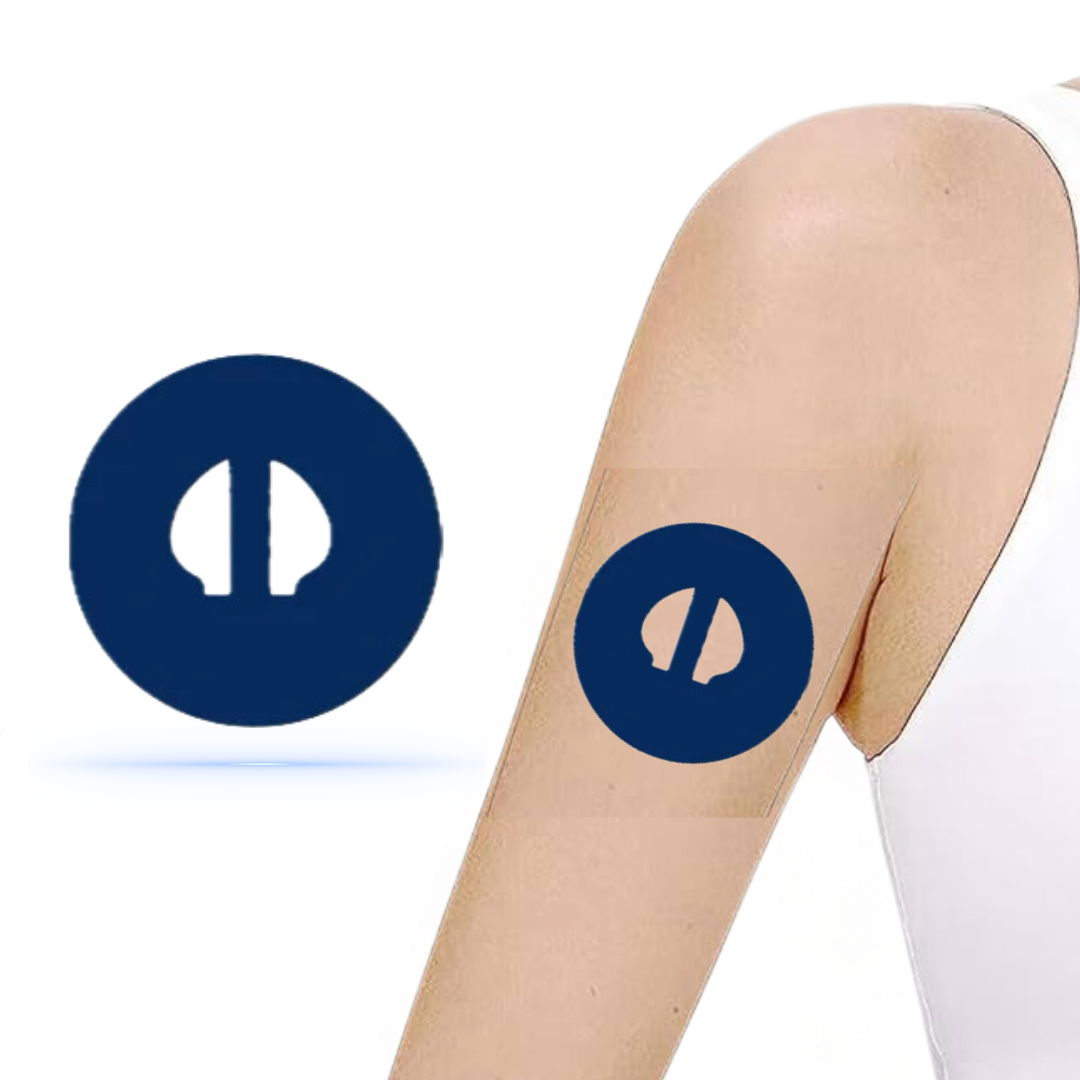 Navy blue CGM-patch på arm som skyddar Medtronic Guardian 4-sensor, kombinerar stil med funktionalitet.