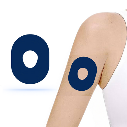 DiabetaGuard Navy Blue CGM patch som sitter på en arm, visar en elegant och säker design för Dexcom One+ sensorer.