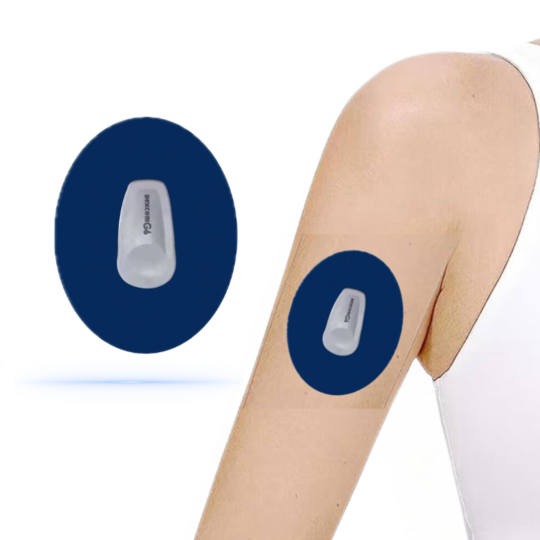 DiabetaGuard Navy Blue CGM patch för Dexcom G6 sensor, applicerad på en arm, som kombinerar stil och funktion.