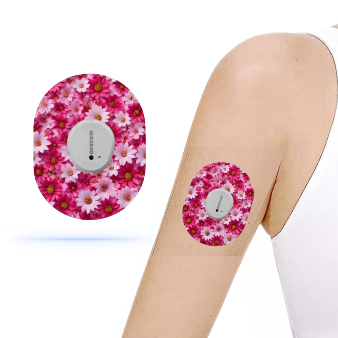 DiabetaGuard Pink Flower CGM patch för Dexcom G7 fästs på överarmen, med ett blommigt rosa mönster som skyddar sensorn med stil och elegans.