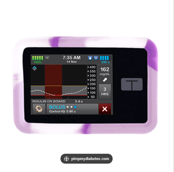 PumpCover – Silikonskydd för Insulinpump Tandem t:Slim X2 - Diabeteshjalp