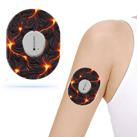 Volcano Lava CGM Sensor Patches för Dexcom G7 (5-pack) - Diabeteshjalp