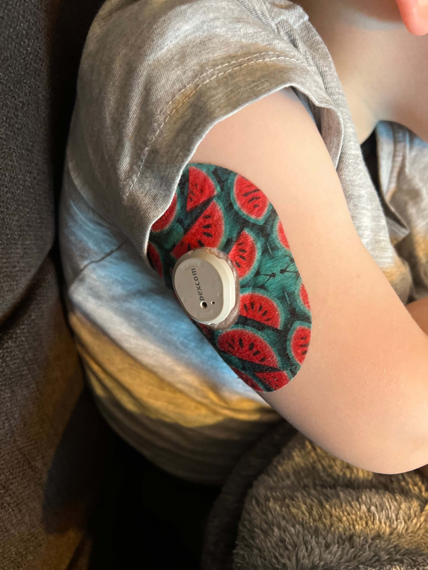 Watermelon CGM sensor Patches för Dexcom G7 ( 5-pack) - Diabeteshjalp