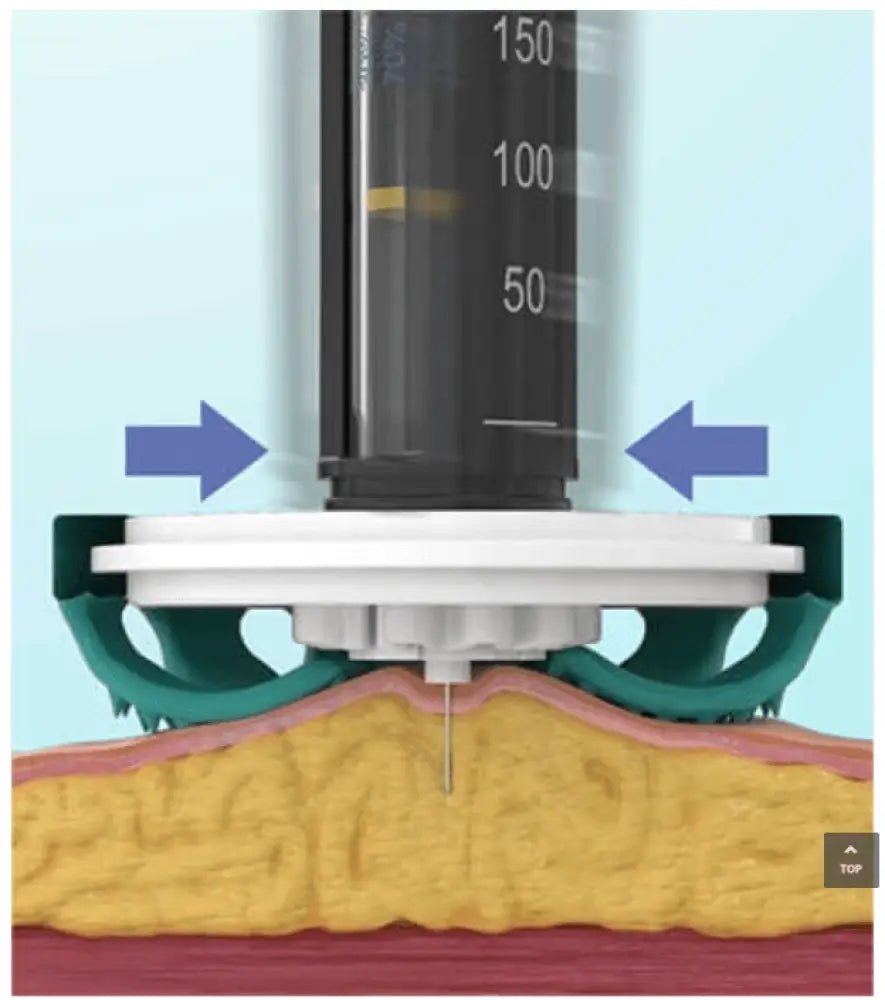 diabeteshjälp Diabetaguard CGMPATCH 