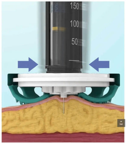 diabeteshjälp Diabetaguard CGMPATCH 