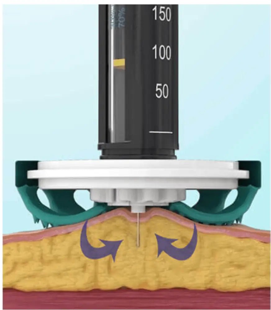 diabeteshjälp Diabetaguard CGMPATCH 