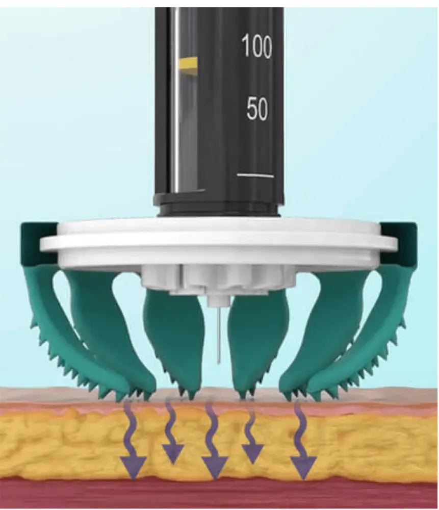 diabeteshjälp Diabetaguard CGMPATCH 